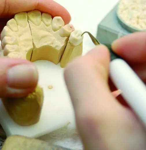 Zahntechniker verzeichnen saisonbedingtes Auftragsplus