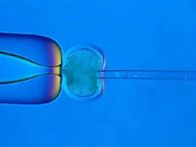 Ärztetag für begrenzte Zulassung der PID