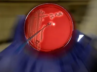 EHEC-Erreger könnte aus Biogasanlagen kommen