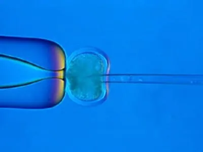 PID-Gegner und -Befürworter bringen sich in Stellung