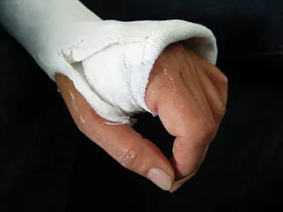 Versicherungsschutz bei Arbeiten im Ausland nur bei Job im Inland