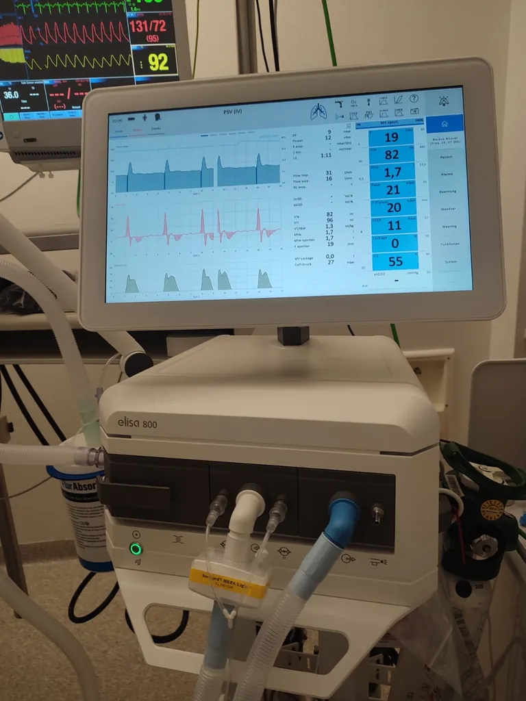Beatmungsger&auml;t auf Covid-Station