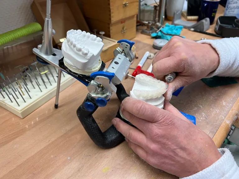 Um die Schiene perfekt an den Patienten anzupassen, muss diese immer wieder ausgebessert und &uuml;berpr&uuml;ft werden.