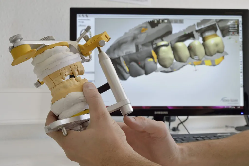 Das Modell eines Gebisses vor einem Bildschirm, der ein digitales Gebissmodell zeigt.