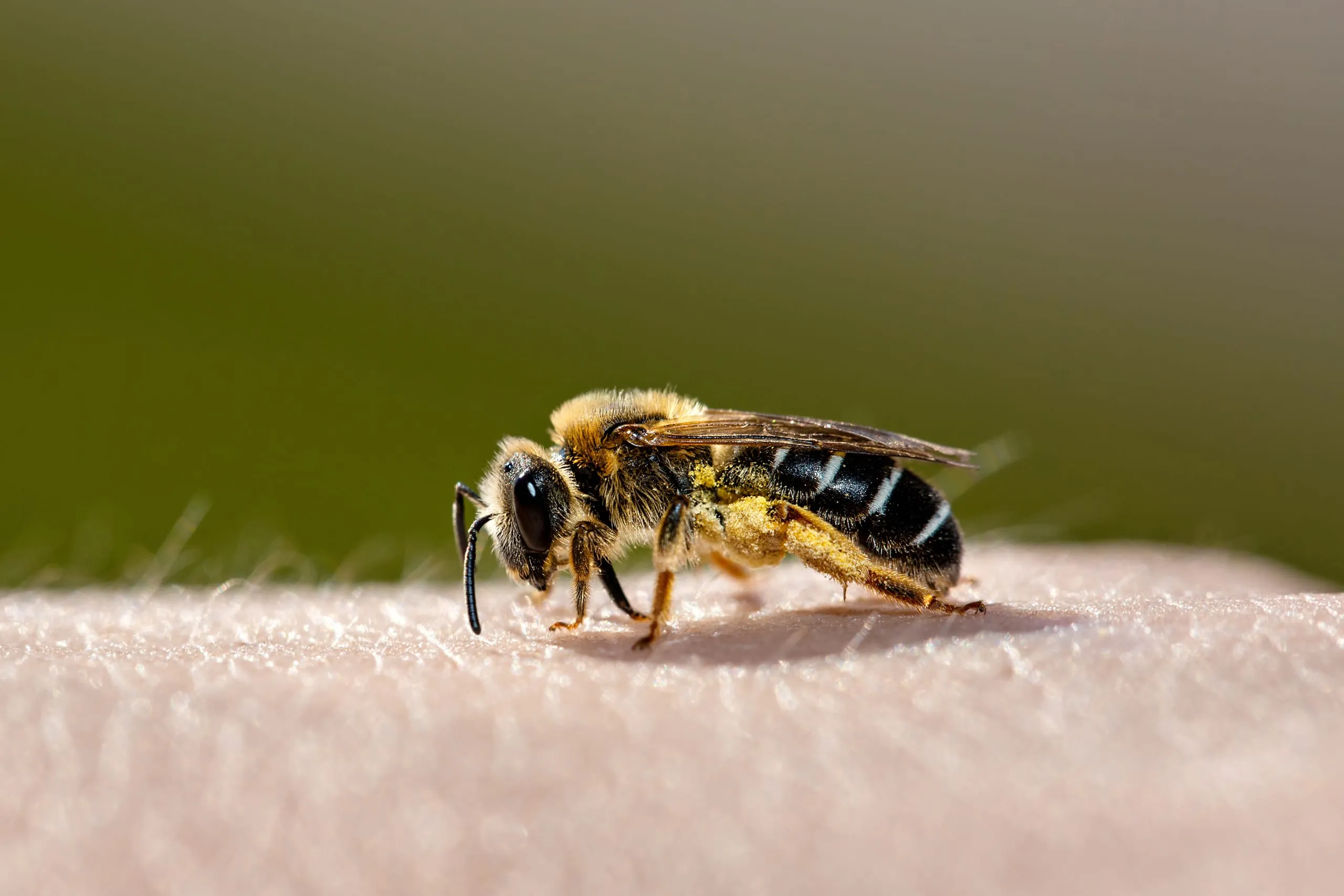 Bienenstich auf Arbeitsweg gilt als Dienstunfall